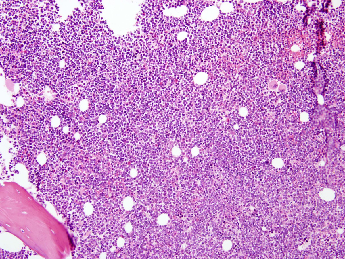 Biopsy core 200x